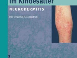 Atopisches Ekzem im Kindesalter (Neurodermitis)