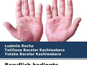 Beruflich bedingte Kontaktdermatitis