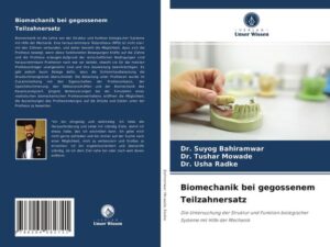 Biomechanik bei gegossenem Teilzahnersatz