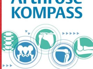 Der Arthrose-Kompass