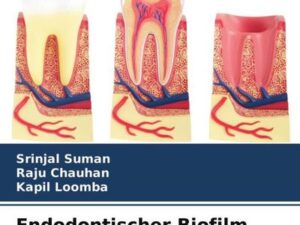 Endodontischer Biofilm