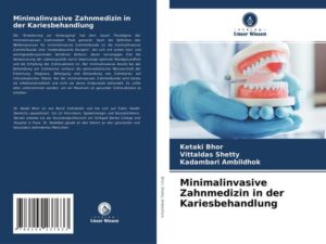 Minimalinvasive Zahnmedizin in der Kariesbehandlung