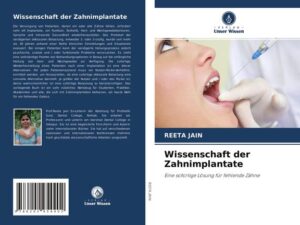 Wissenschaft der Zahnimplantate