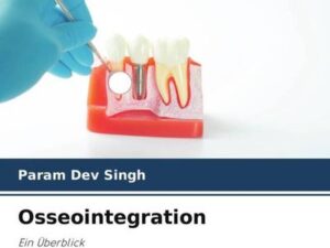 Osseointegration